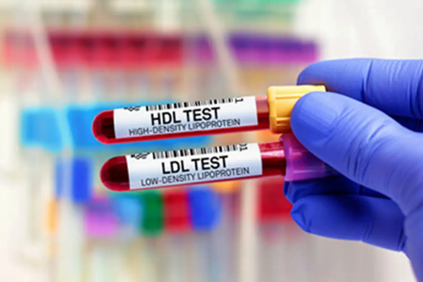 Cholesterol – The Hidden Danger